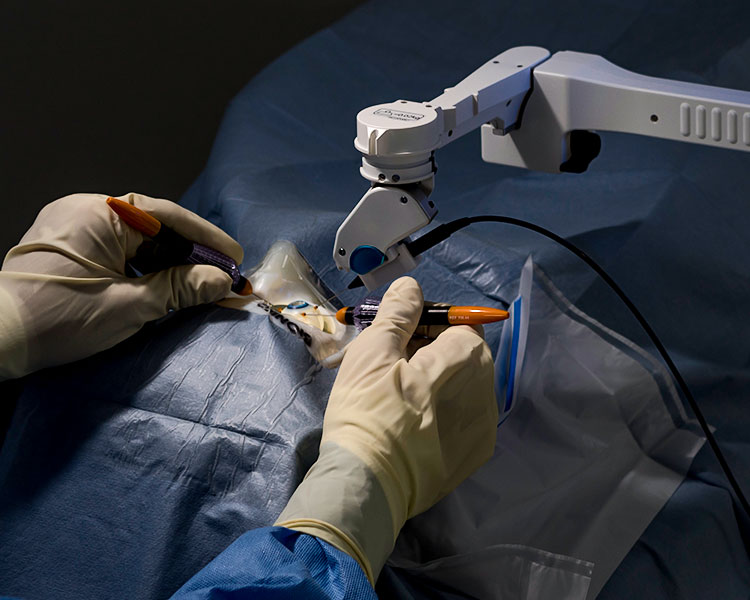 The endoscope is held by the robotic arm.